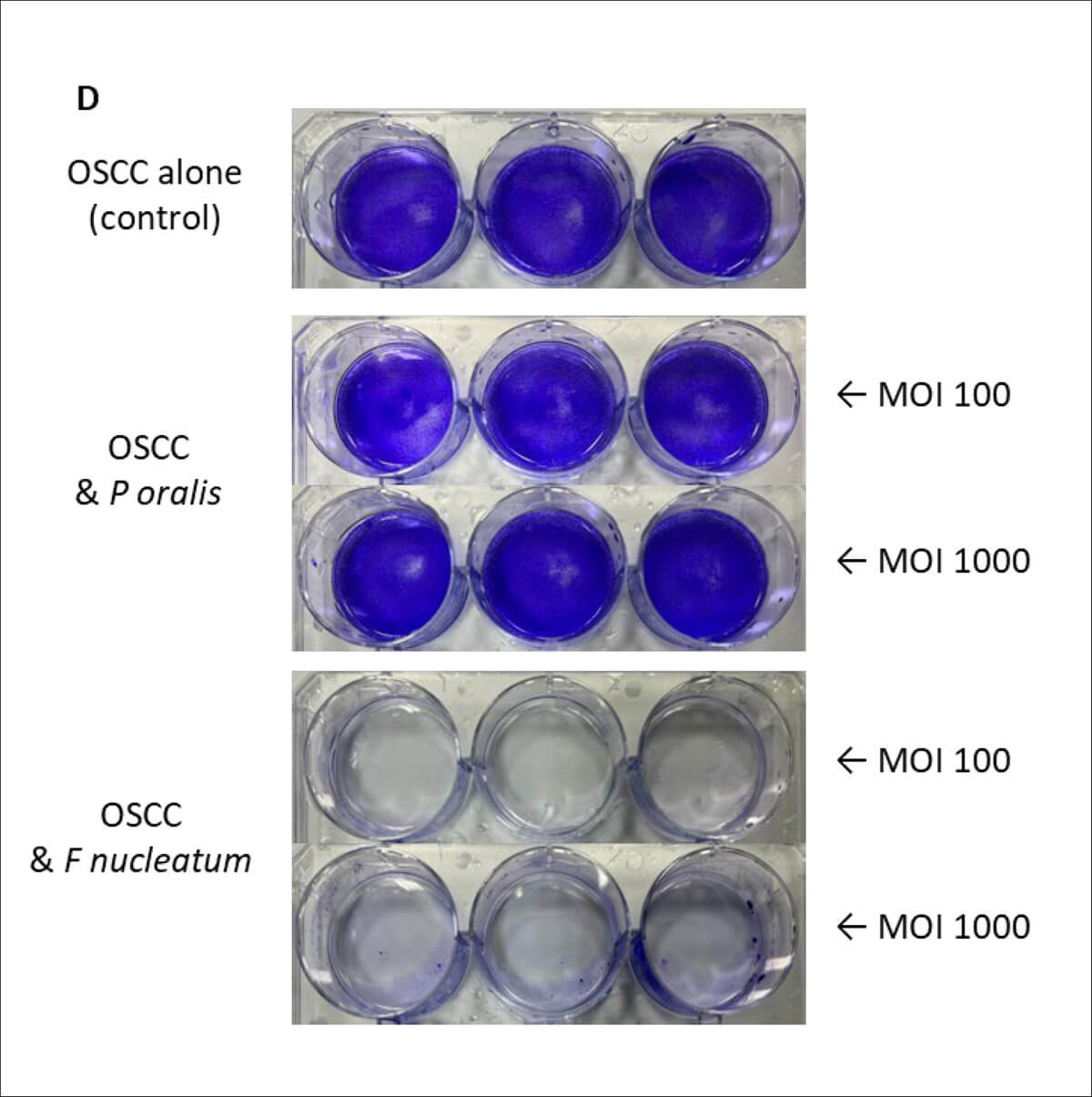 Image connected to oral microbiota in head and neck squamous cell carcinoma article.