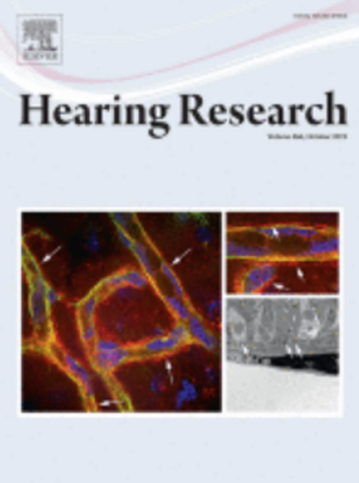 Hearing Research journal cover image.