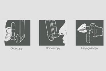 Telescopic ENT referrals