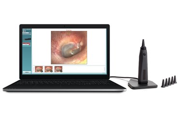 Viot™ – Video otoscope