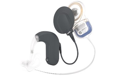 SYNCHRONY EAS Hearing Implant System