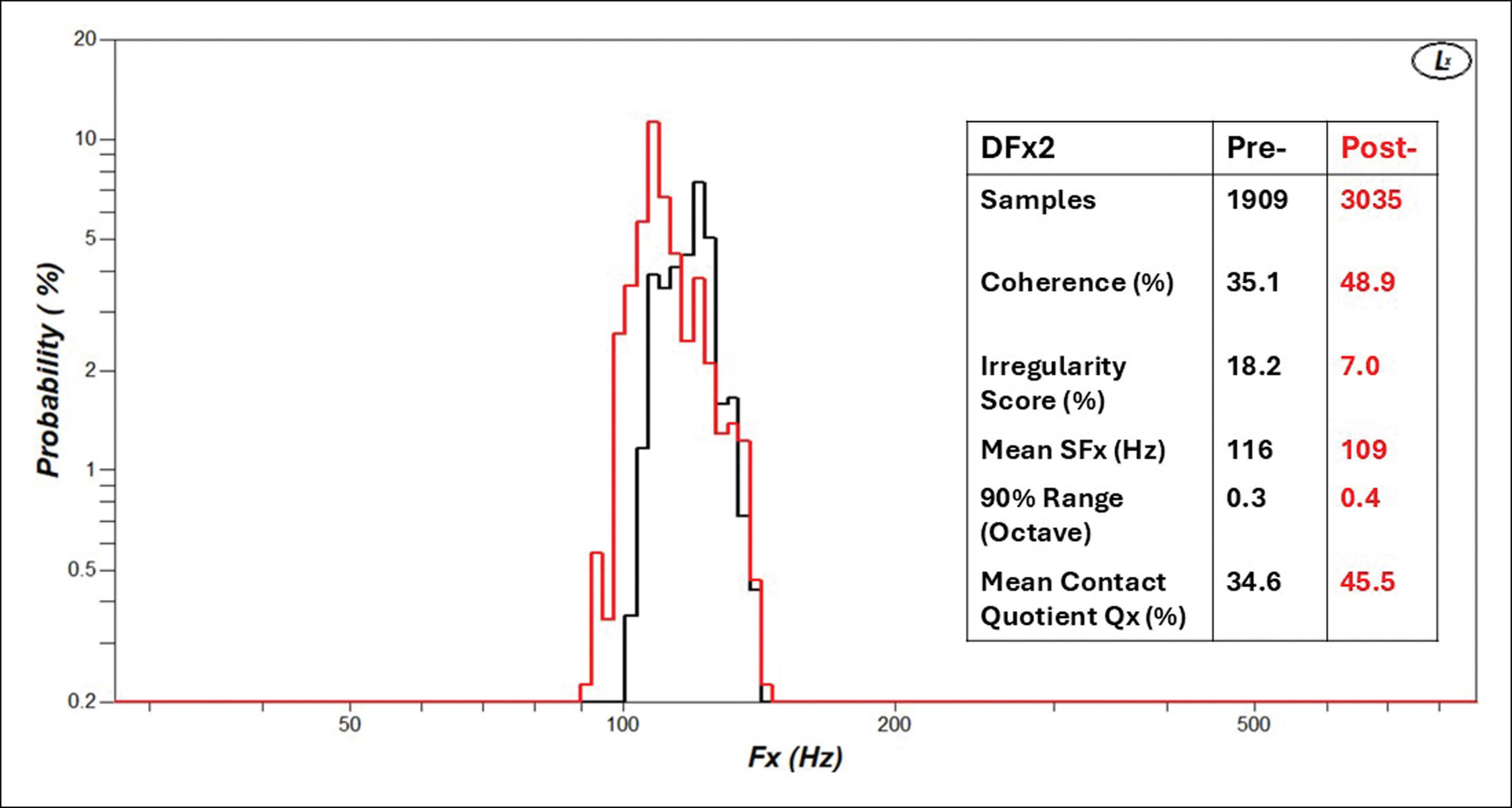 Diagram showing Illustrative DFx2 frequency distributions (53-year-old male, recurrent laryngeal palsy, pre- and post-thyroplasty) after reading ‘Arthur the Rat’ for two minutes. 