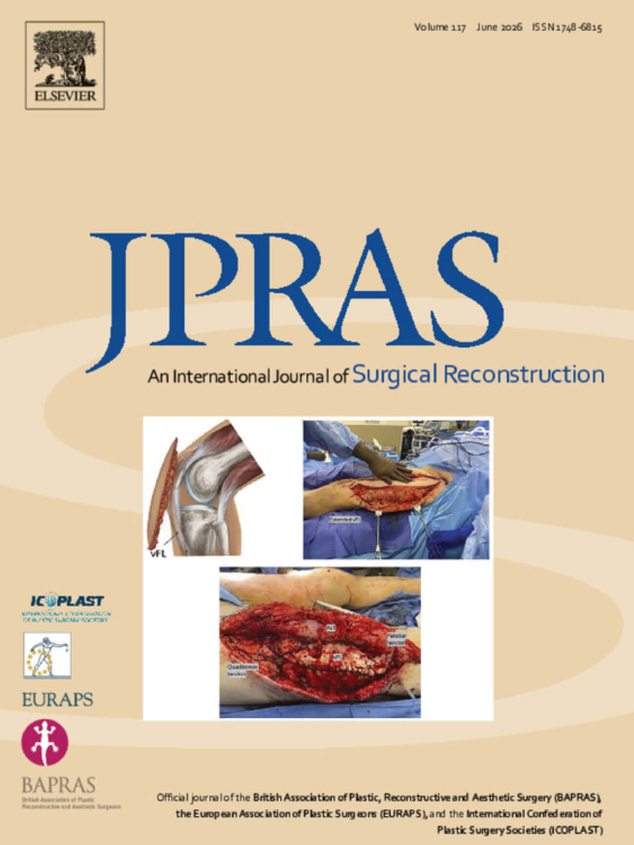 JPRAS journal cover image.
