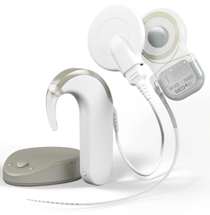 Rehabilitation of singlesided deafness with cochlear implants ENT