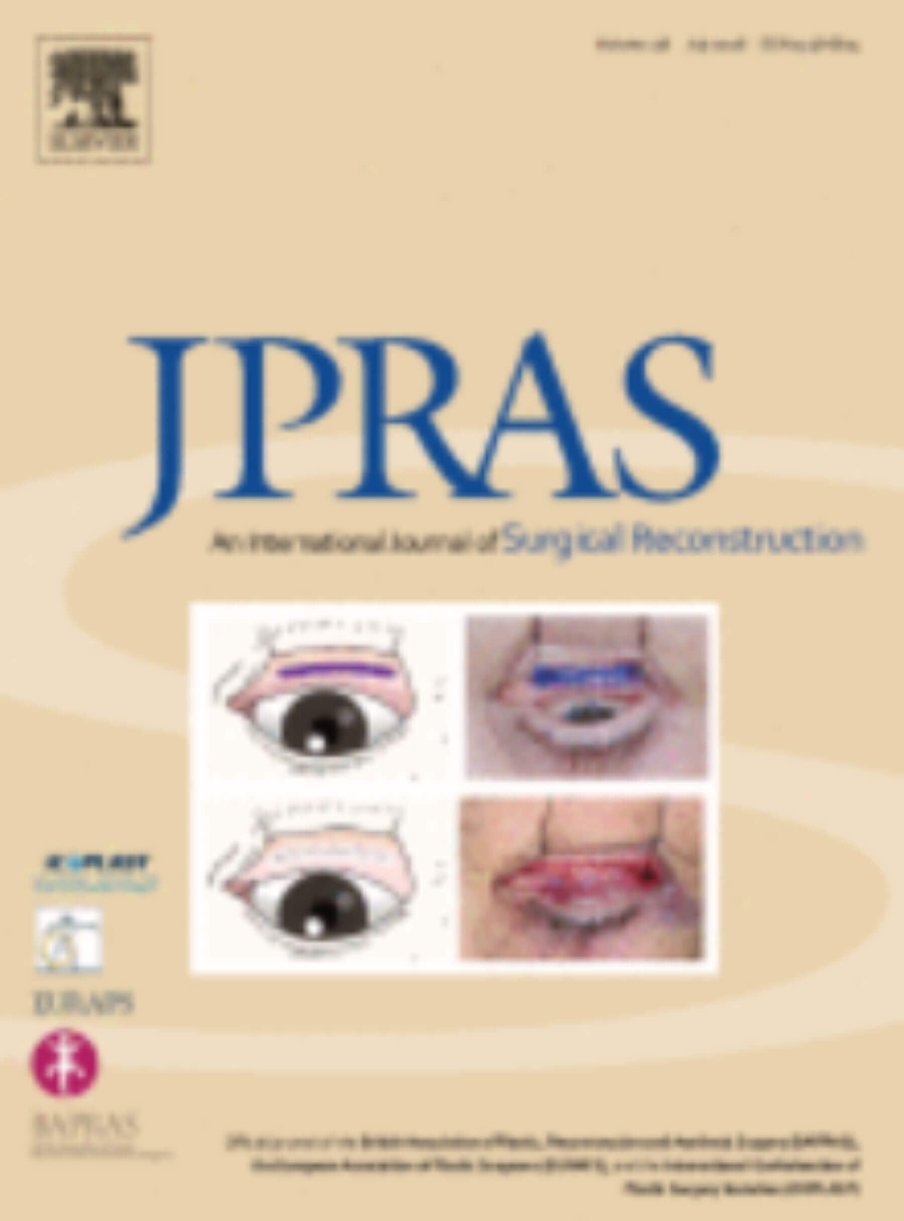 JPRAS journal cover image.