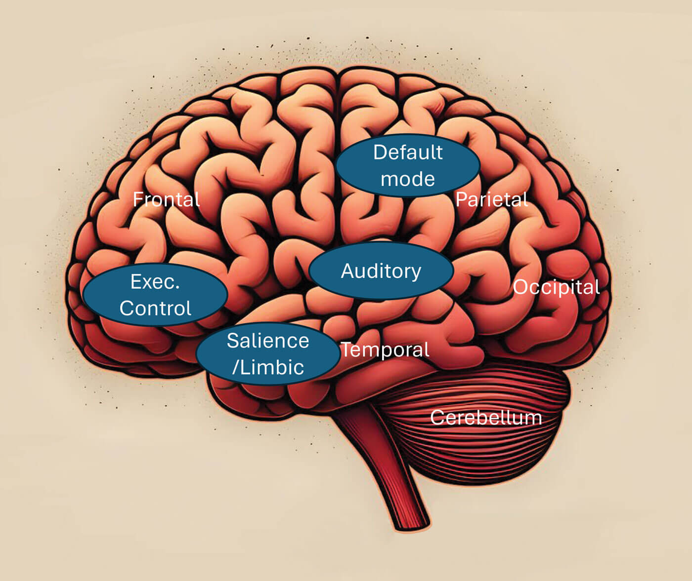 Illustration showing typical tinnitus-related networks in the brain.