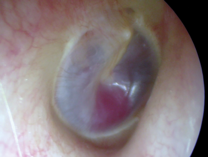 A Practical Approach To Tinnitus Ent Audiology News A Practical Approach To Tinnitus Ent Audiology News