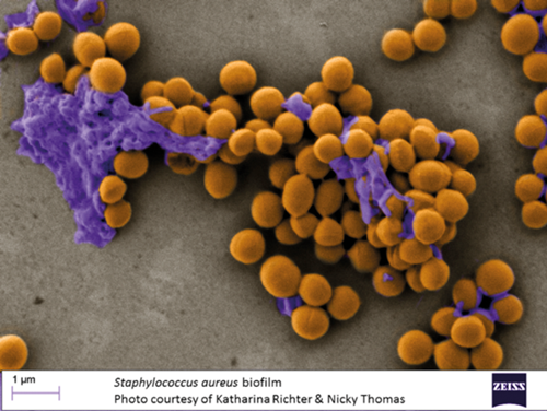 Staphylococcus aureus as a cause of refractory chronic rhinosinusitis