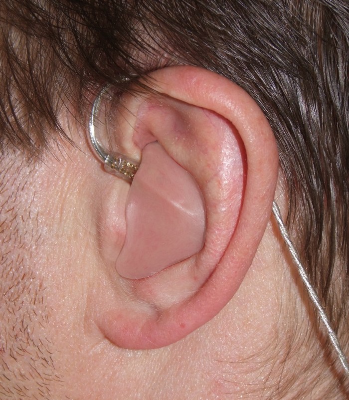 in ear stage